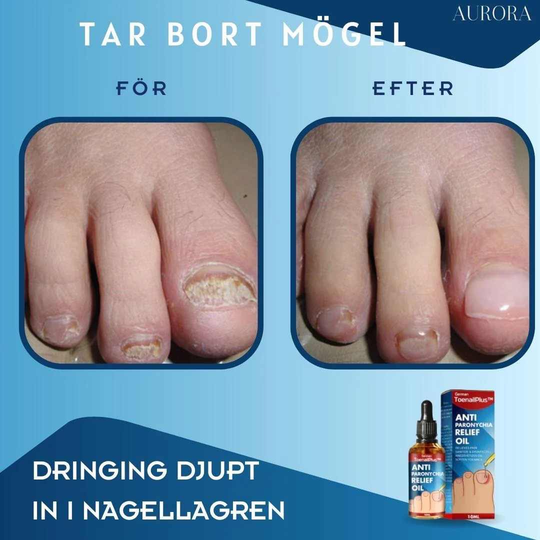 Miniatyrbild 2